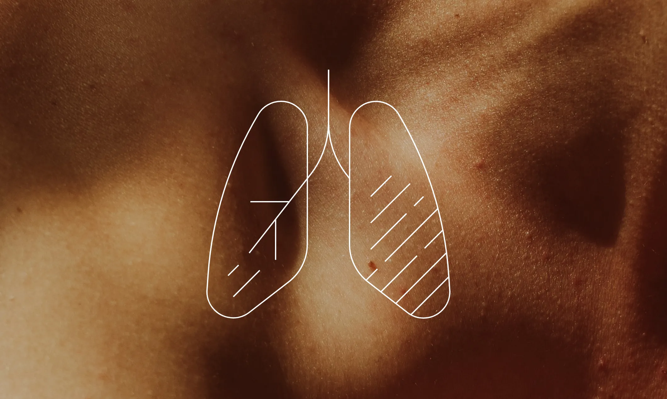 03_HAL-Header_Lungenkrebs