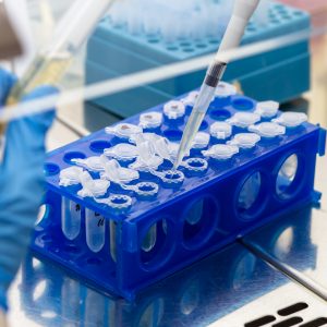 Conducting laboratory research and tests in the clinic laboratory, introducing liquid into the Eppendorf in a stand using a dispenser.